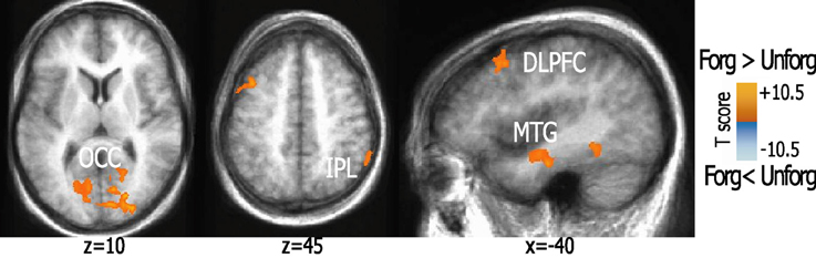 forgiveness brings healing to brain